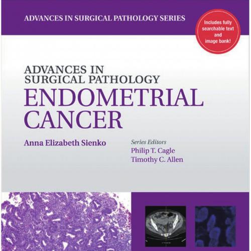 Advances in Surgical Pathology Mesothelioma