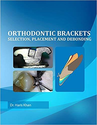 Orthodontic Brackets Selection,Placement and Debonding