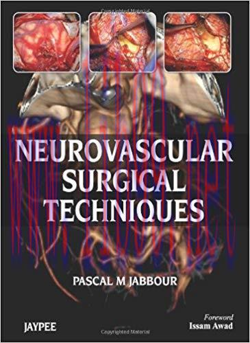 [PDF]Neurovascular Surgical Techniques