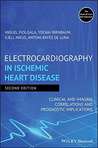 Electrocardiography in Ischemic Heart Disease 2nd Edition