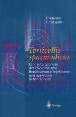 [PDF]Torticollis spasmodicus: Langzeitergebnisse der Physiotherapie, Botulinumtoxin-Injektionen...