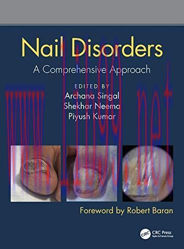 [AME]Nail Disorders: A Comprehensive Approach