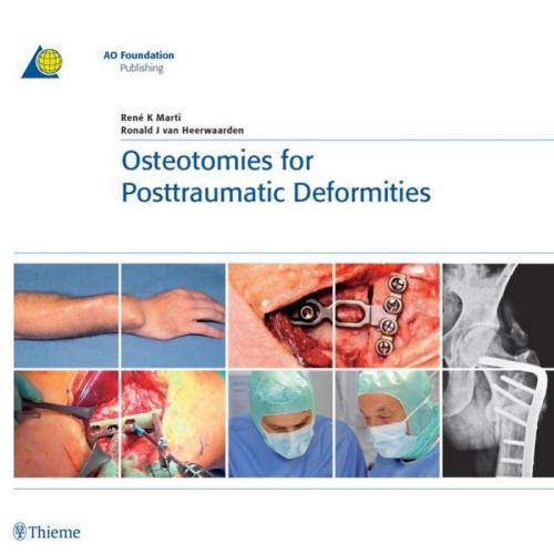 Thieme_ Osteotomies for Posttraumatic Deformities