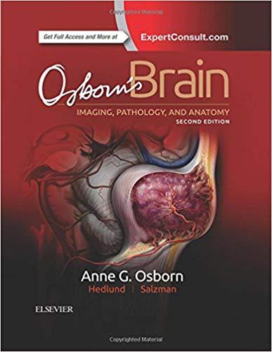 Osborn&rsquo;s Brain 2nd Edition