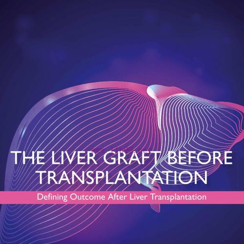 [AME]The Liver Graft Before Transplantation: Defining Outcome After Liver Transplantation (EPUB...