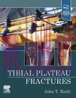 [PDF]Tibial Plateau Fractures