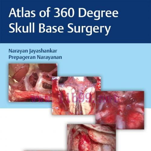 [PDF]Atlas of 360 Degree Skull Base Surgery