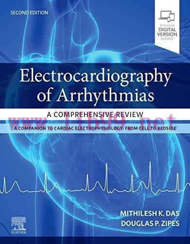 [AME]Electrocardiography of Arrhythmias: A Comprehensive Review: A Companion to Cardiac Electro...