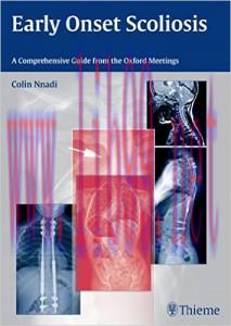 [AME]Early Onset Scoliosis: A Comprehensive Guide from_ the Oxford Meetings