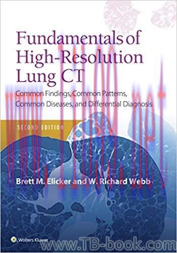 Fundamentals of High-Resolution Lung CT: Common Findings, Common Patterns, Common Diseases and ...