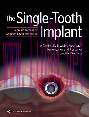 [AME]The Single-Tooth Implant: A Minimally Invasive Approach for Anterior and Posterior Extract...
