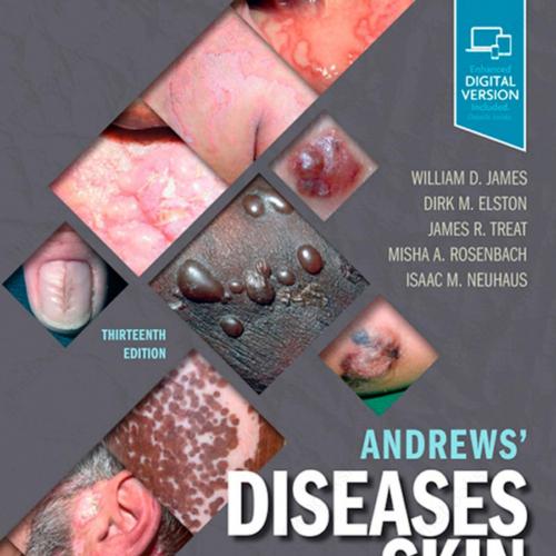Andrews' Diseases of the Skin_ Clinical Dermatology 13th - WillJames R. Treat MD & Misha A. Ros...