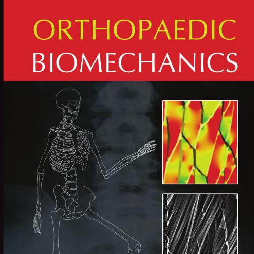 Orthopaedic Biomechanics