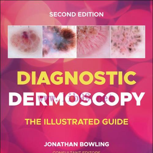 [AME]Diagnostic Dermoscopy: The Illustrated Guide, 2nd Edition (EPUB)