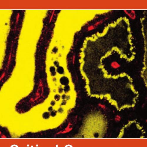 Critical Care Nephrology