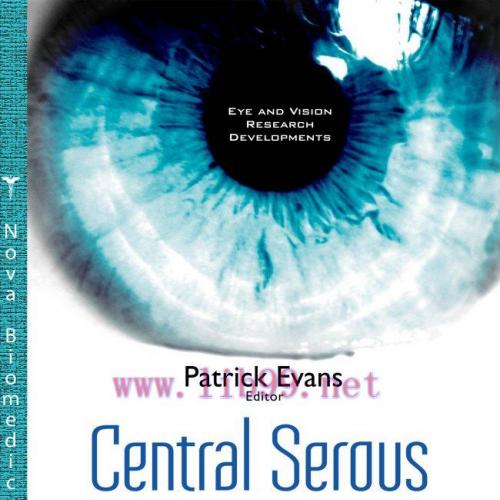 [AME]Central Serous Chorioretinopathy: Risk Factors, Diagnosis and Management (ORIGINAL PDF)