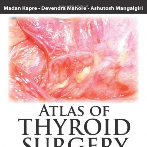 Atlas of Thyroid Surgery