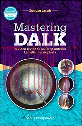 [PDF]Mastering DALK a video textbook on deep anterior lamellar