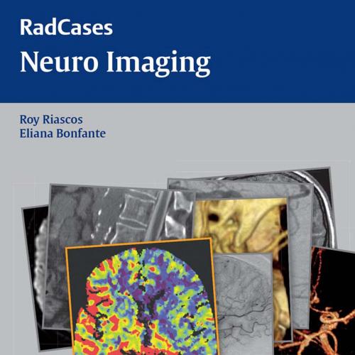 Neuro Imaging