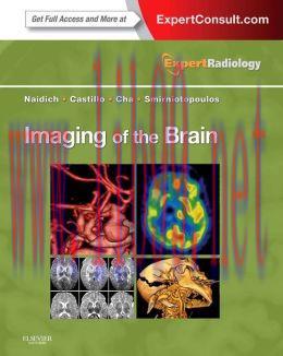 [AME]Imaging of the Brain: Expert Radiology Series (ORIGINAL PDF from_ Publisher)