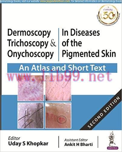 [AME]Dermoscopy, Trichoscopy & Onychoscopy In Diseases of the Pigmented Skin An Atlas and Short...