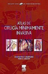 [AME]Atlas De Cirugia Minimamente Invasiva (Spanish Edition) (Original PDF)