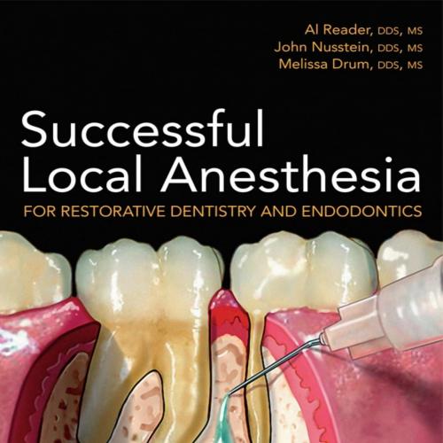 Successful Local Anesthesia_ For Restorative Dentistry and Endodontics-Al Reader, John Nusstein...
