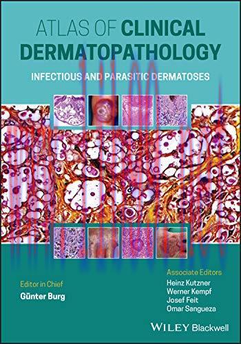 [AME]Atlas Clinical of Dermatopathology: Infectious and Parasitic Dermatoses (Original PDF)