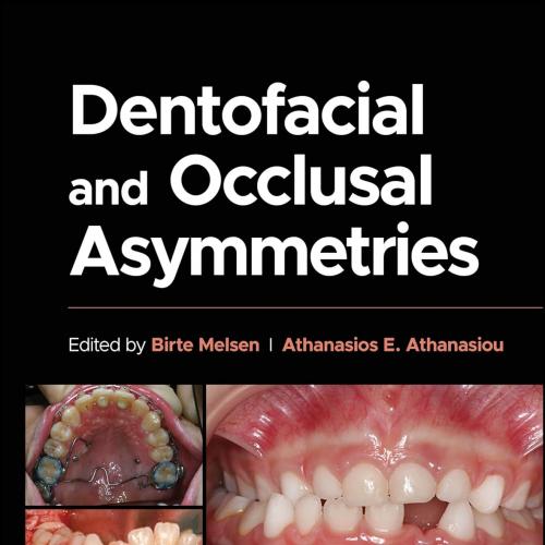 Dentofacial and Occlusal Asymmetries 1st Edition