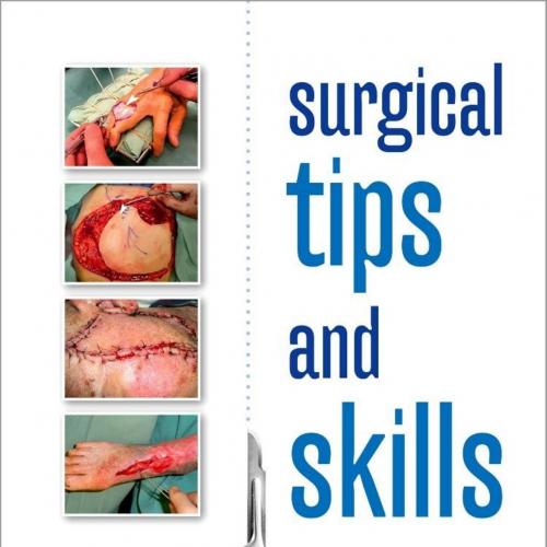 Surgical Tips and Skills, 1E (2014) - Wei Zhi