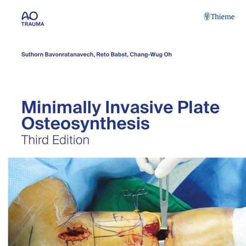 [AME]Minimally Invasive Plate Osteosynthesis (AO-Publishing), 3rd edition (ePub+Converted PDF)