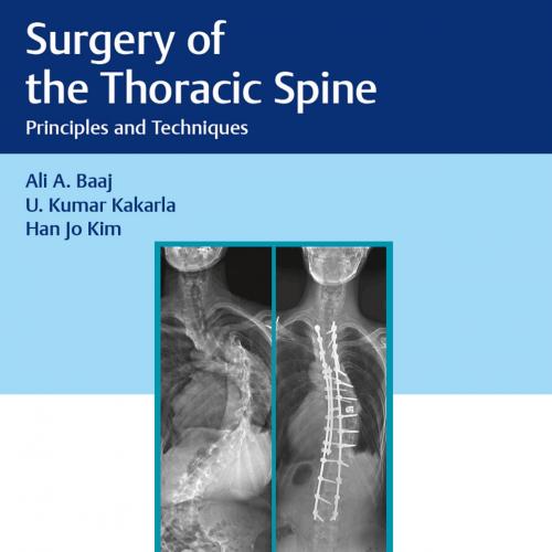 Thieme Surgery of the Thoracic Spine Principles and Techniques