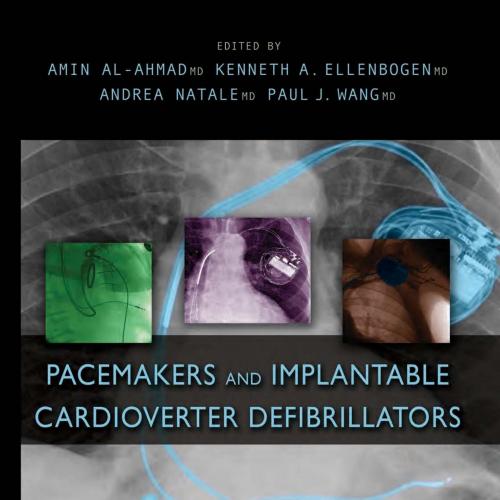 Pacemakers and Implantable Cardioverter Defibrillators