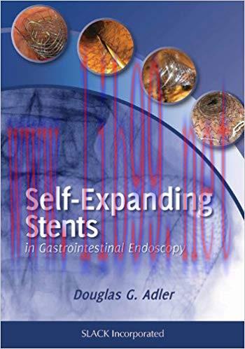 [PDF]Self-Expanding Stents in Gastrointestinal Endoscopy