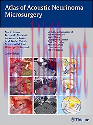 [PDF]Atlas of Acoustic Neurinoma Microsurgery