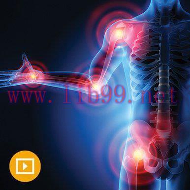 [AME]The Brigham Board Review and Comprehensive Update_ in Rheumatology 2022 (CME VIDEOS)