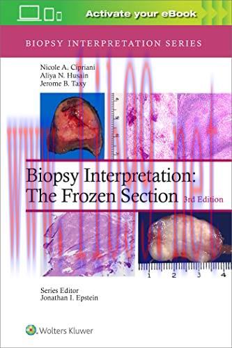 [AME]Biopsy Interpretation: The Frozen Section, 3rd Edition (Biopsy Interpretation Series) (EPU...