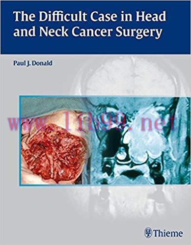 [PDF]The Difficult Case in Head and Neck Cancer Surgery