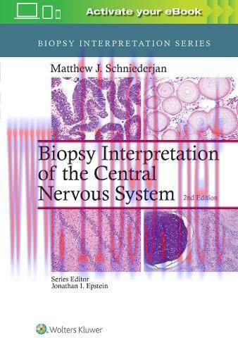[AME]Biopsy Interpretation of the Central Nervous System, 2nd Edition (EPUB)