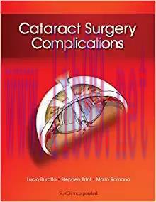 [PDF]Cataract Surgery Complications