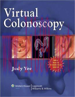 [AME]Virtual Colonoscopy