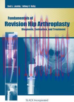 [AME]Fundamentals of Revision Hip Arthroplasty: Diagnosis, Evaluation, and Treatment