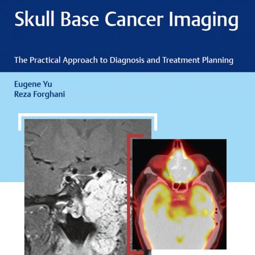 Skull Base Cancer Imaging - Yu, Eugene; Reza Forghani;