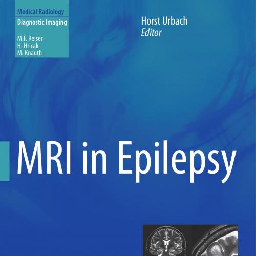 MRI in Epilepsy by Horst Urbach
