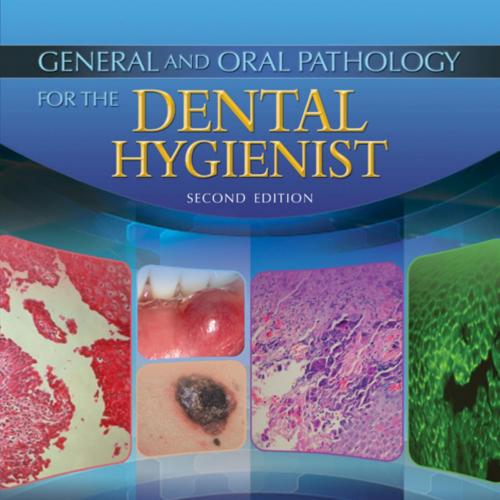 General and Oral Pathology for the Dental Hygienist, 2nd Edition