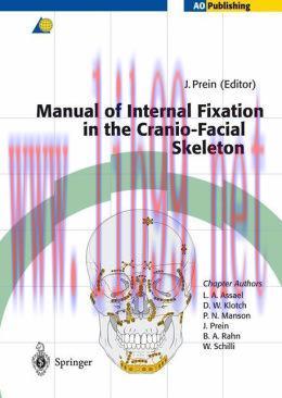 [AME]Manual of Internal Fixation in the Cranio-Facial Skeleton: Techniques Recommended by the A...