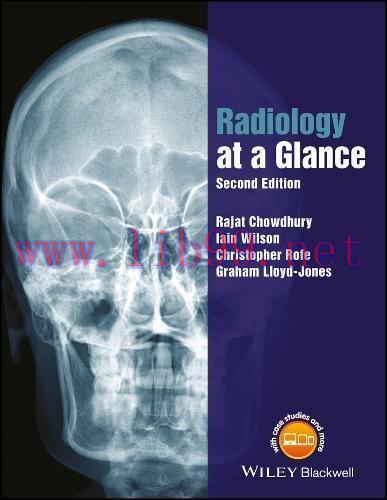 [AME]Radiology at a Glance, 2nd Edition (EPUB)