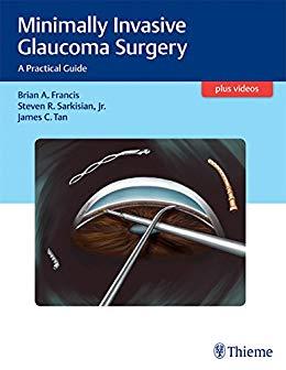 Minimally Invasive Glaucoma Surgery A Practical Guide + Videos