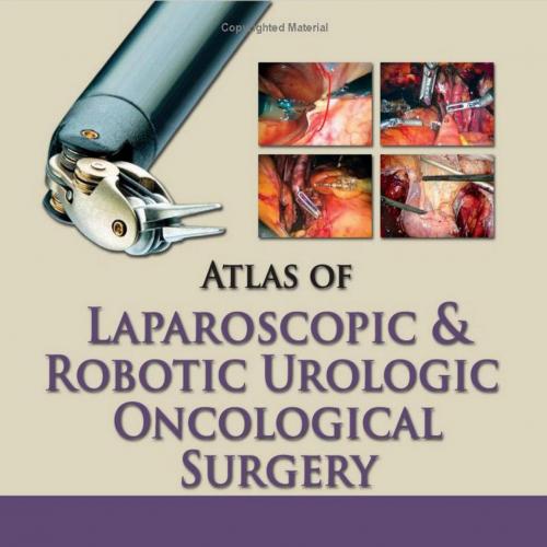 Atlas of Laparoscopic and Robotic Urologic Oncological Surgery