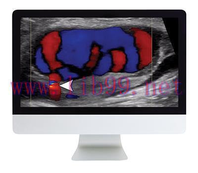 [AME]Clinical Ultrasound Review 2017 (ARRS VIDEOS) (CME VIDEOS)